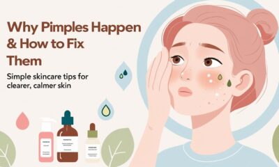 What Is The Main Reason For Pimples?
